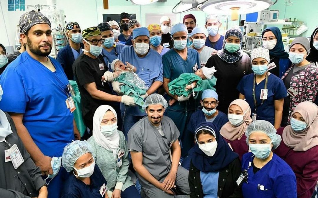 الدكتور عبدالله بن معيض الزهراني يشارك في في عملية فصل التوأم السيامي اليمني